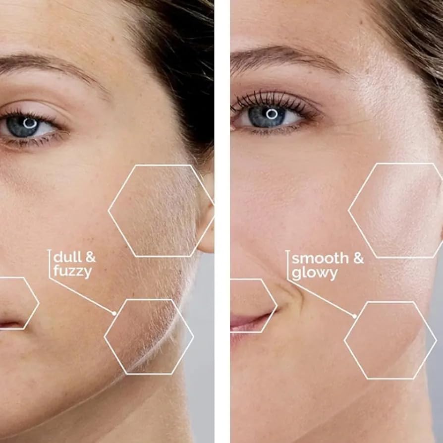 ECOMNEST'S Facial Hair Remover Machine For Men & Women